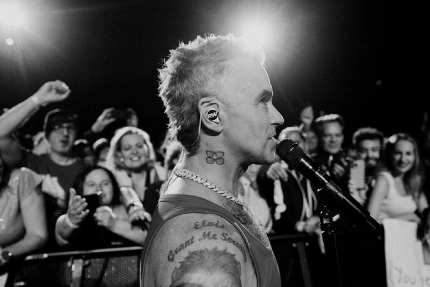 Ρόμπι Γουίλιαμς: “Οι ενέσεις αδυνατίσματος μου προκαλούν τύφλωση”