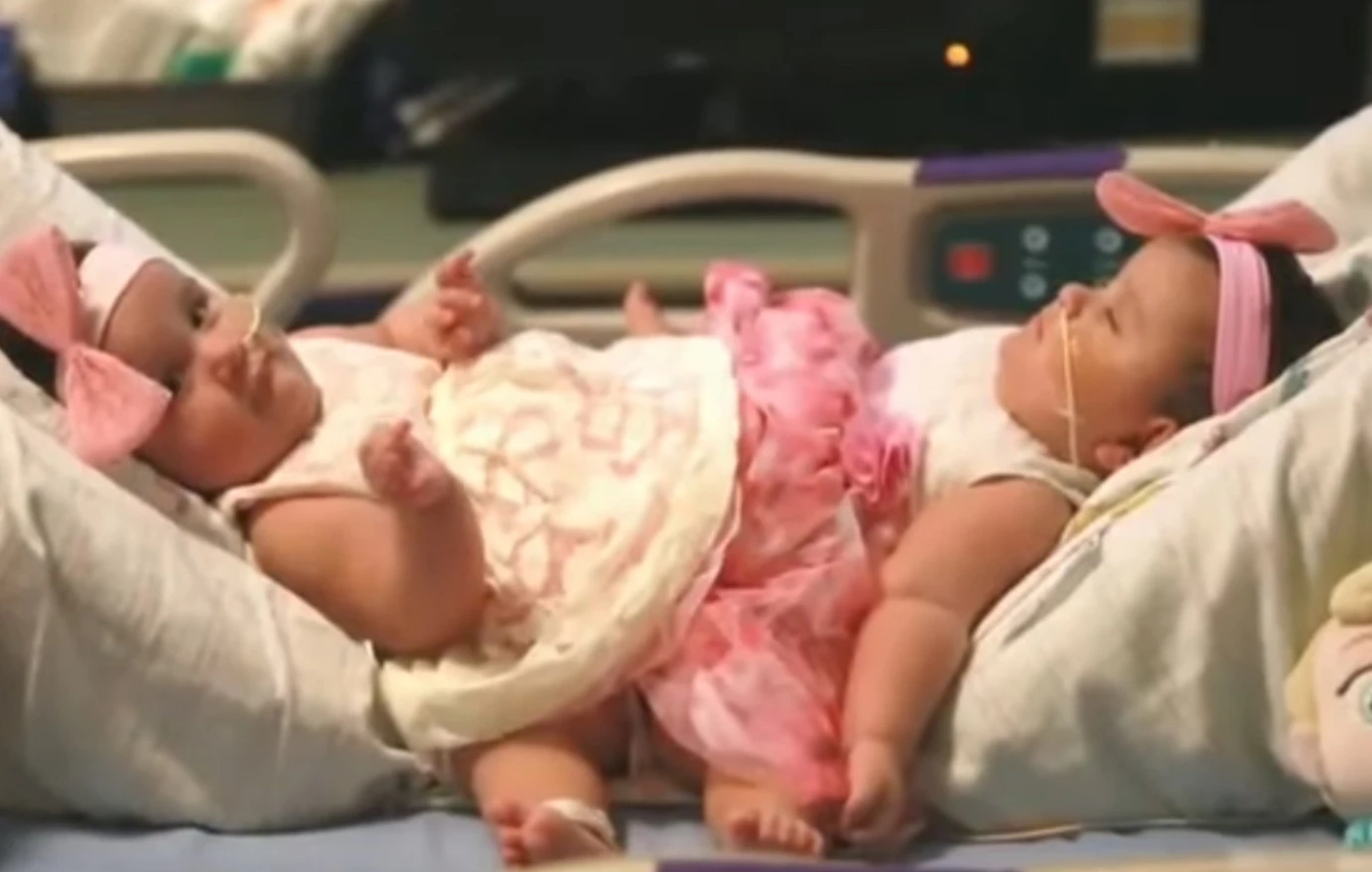 Σιαμαίες που σύμφωνα με τους γιατρούς δεν θα περπατούσαν ποτέ, τώρα διαπρέπουν στο Cheerleading