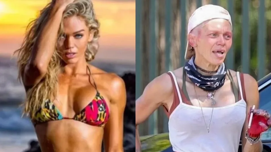 Λόνι Γουίλισον: Από διάσημο μοντέλο με μεγάλη περιουσία, άστεγη στους δρόμους να τρώει από τα σκουπίδια