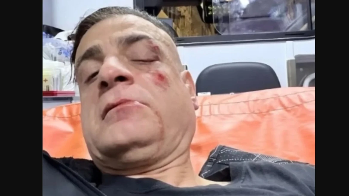 Άγριος ξυλοδαρμός Youtuber στο μετρό της Ρώμης από πορτοφολάδες που κατέγραφε σε βίντεο