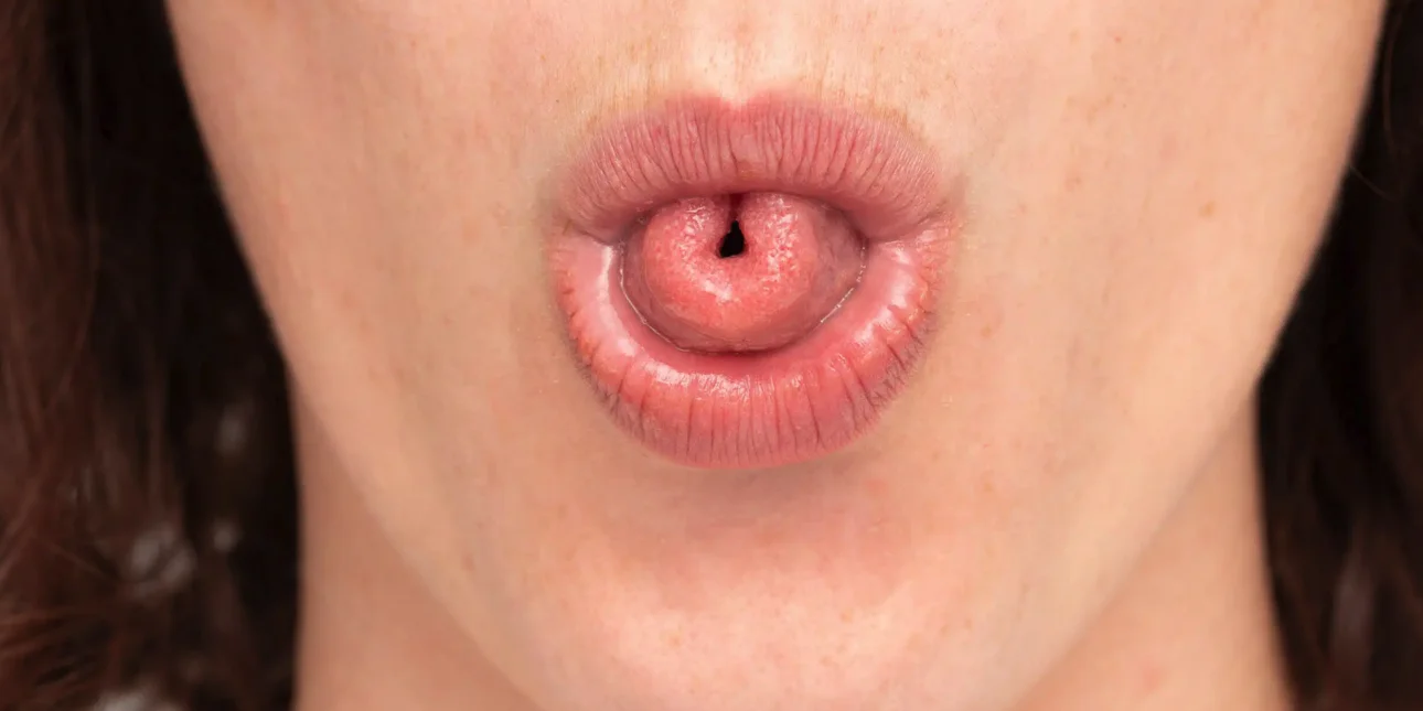 Ψυχολογία: Τι σημαίνει η ικανότητα να διπλώνεις τη γλώσσα σου σε σχήμα «U»